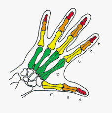 hand with Fibonacci bones